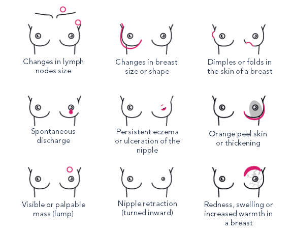 Breast_cancer_signs_and_symptoms